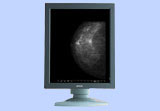 vai alla sezione monitor per mammografia